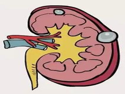 肾囊肿检查哪种可靠？肾囊肿较好别吃得太咸
