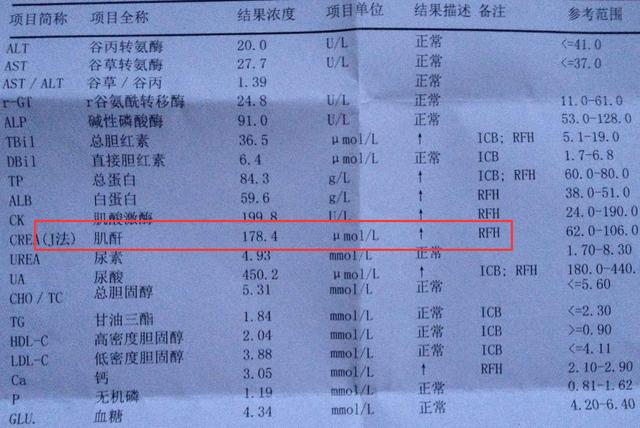 肌酐偏高是怎么回事? 肌酐高怎么办?